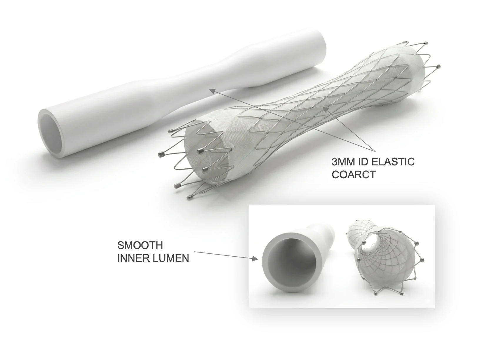Cross-section detail of the elastic flow-control graft showing the calibrated inner geometry